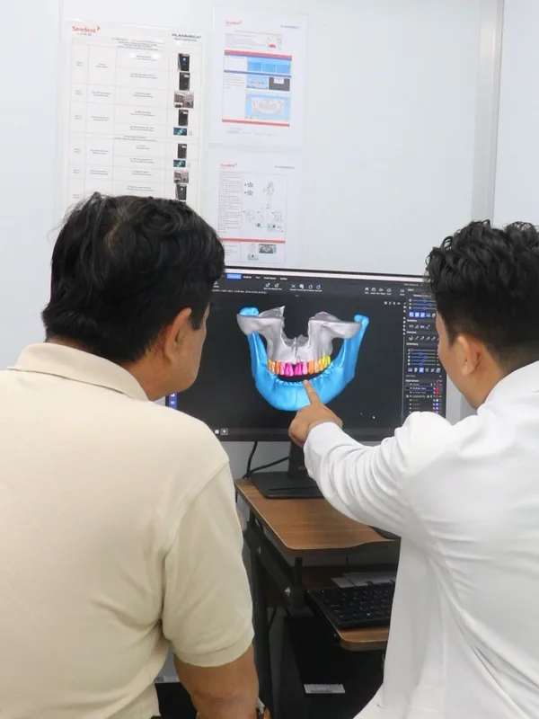 Hội chẩn và lập phác đồ cấy ghép Implant tại Sante