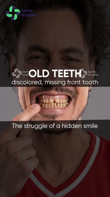 Phục hình toàn hàm cấy ghép Implant tiêu chuẩn quốc tế